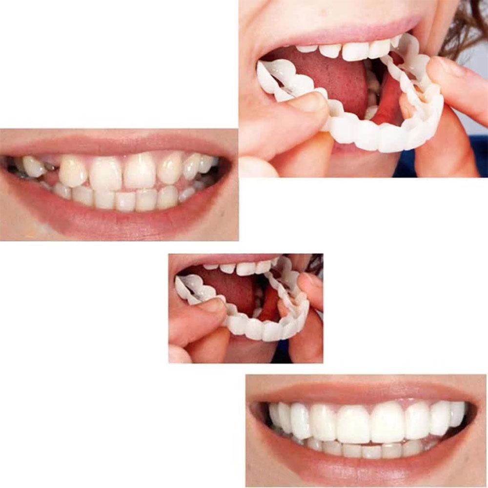 1Pcs Retain Smile Comfort Fit Flex Teeth Denture Teeth Top Cosmetic Perfect Smile Veneer Teeth Top Cosmetic Dental Veneer